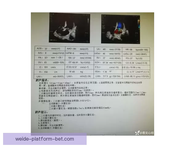 勇士伤情最新：霍福德波斯特康复顺利下周复查结果可期